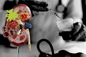 Scientists Identify Key Pathway Underlying Kidney Disease